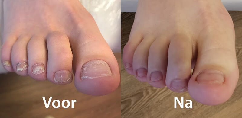 Foto van Medische Pedicure Kempen