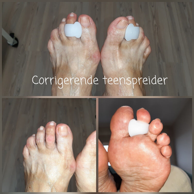 Foto van Footcare kristel menu