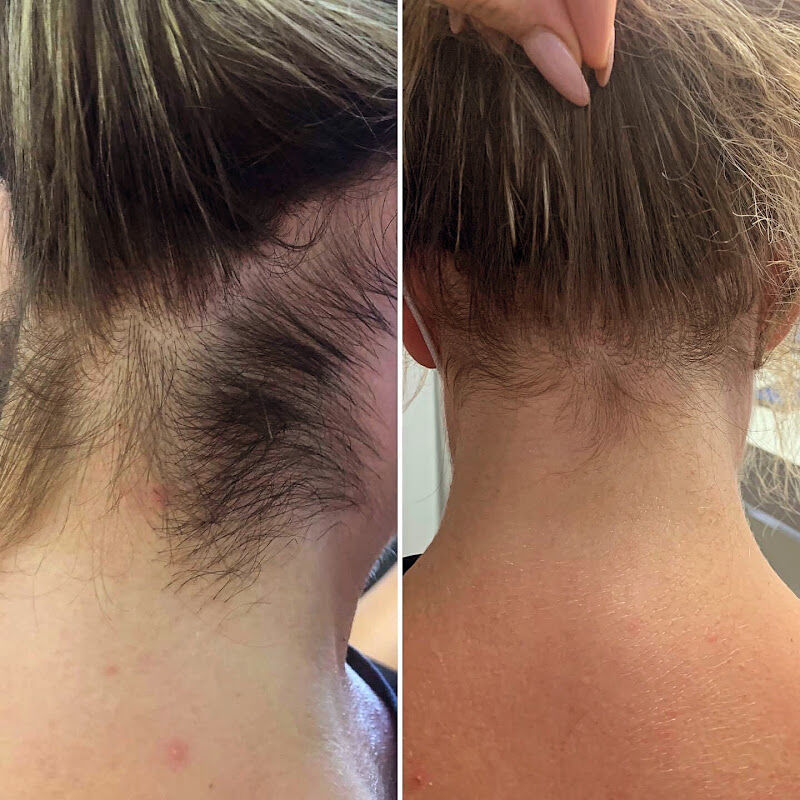 Foto van Haar Laser Team