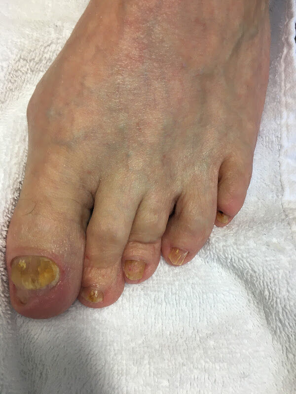 Foto van Footsteps -Gespecialiseerde Voetverzorgster