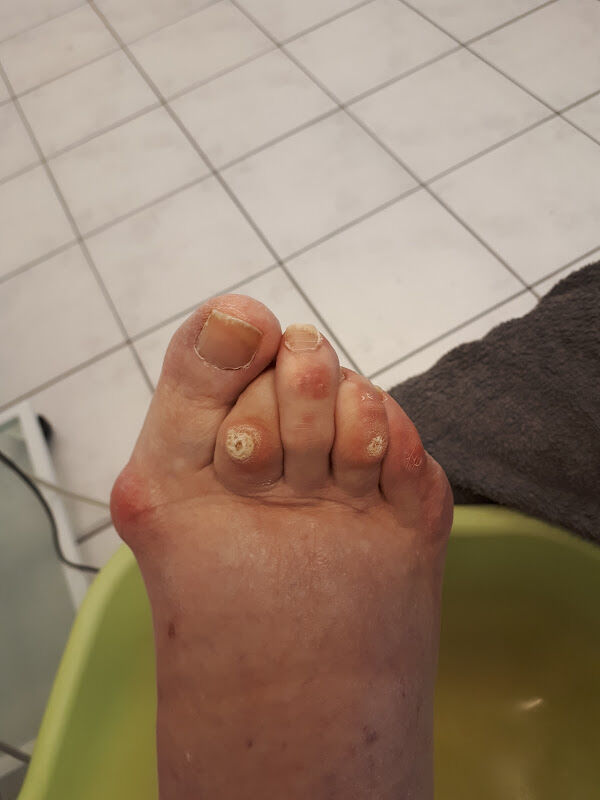 Foto van Pescura Medische Pedicure -manicure -ontharing
