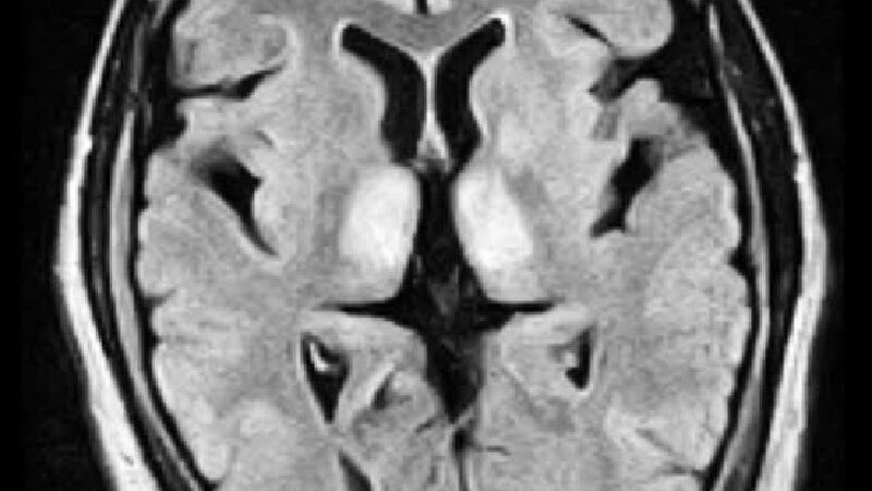 Foto van Praktijk dr. Pieter Viaene Neurologie Genk