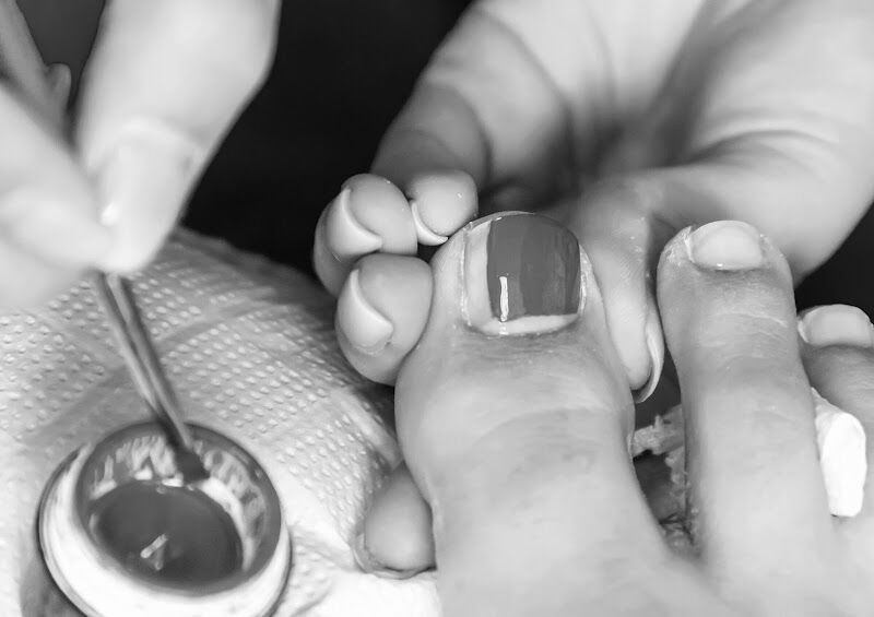 Foto van Socialfeet - Gespecialiseerde voetverzorging aan huis