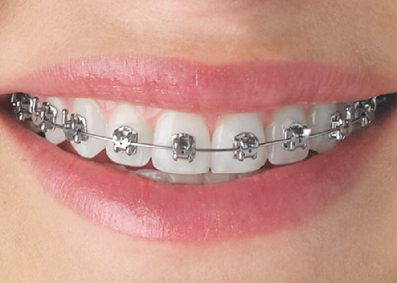 Foto van Orthodontie Desmedt Diksmuide