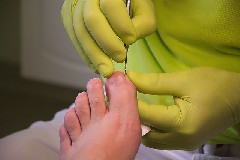 Foto van Medische Pedicure Weltjens Ann