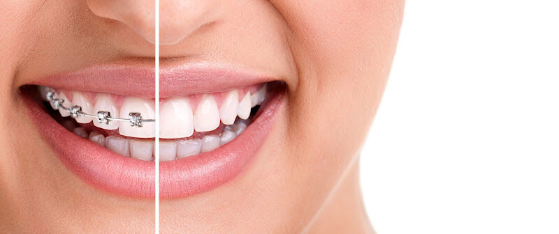 Foto van Fanni SCHMIDT dr., Tandarts-specialist in de orthodontie