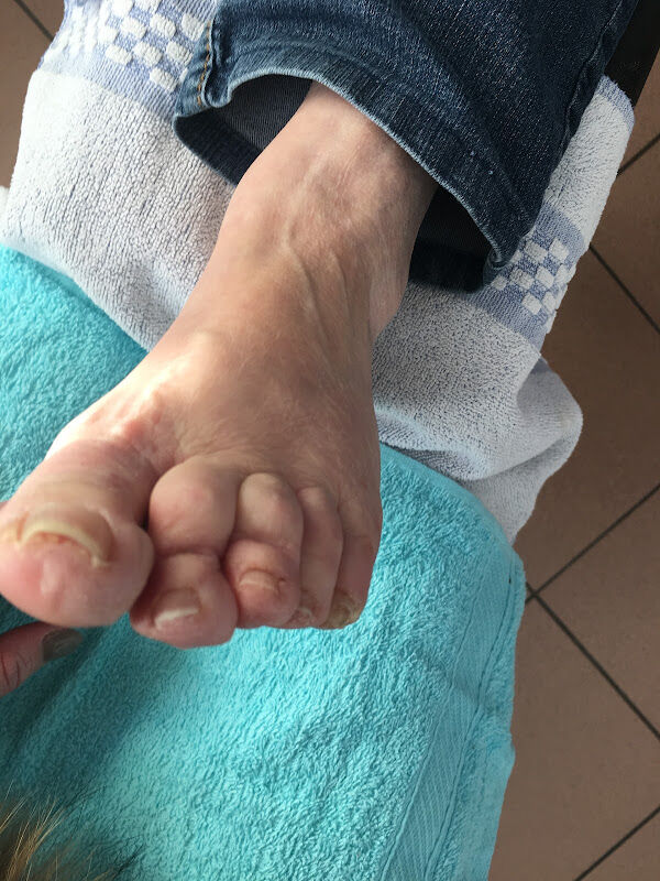 Foto van Thuisverpleging/Medische Pedicure aan huis Charlyn Deruyck
